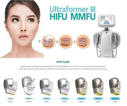 ultraformer